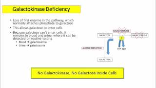 12DaysinMarch Galactose Metabolism for USMLE Step One [upl. by Hana]