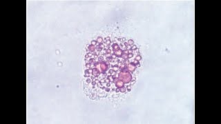 STAINING TECHNIQUES IN URINALYSIS [upl. by Keynes]