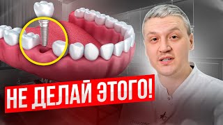 😮КОМУ НЕЛЬЗЯ ставить ЗУБНЫЕ ИМПЛАНТЫ😮 Плюсы минусы и противопоказания от стоматолога [upl. by Deppy]