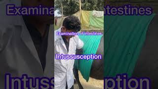 Diagnosis of Intussusception l dr Umar khan [upl. by Sackey]