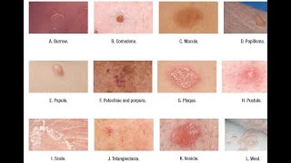 Skin Lesions with defination [upl. by Geneva]