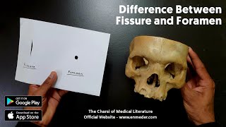 Difference Between Fissure and Foramen  The Charsi of Medical Literature [upl. by Watkin]