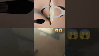 Tracheostomy procedure 3D animation [upl. by Latouche]