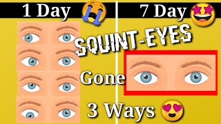 Squint Eye correction NATURALLY with exercises at Home [upl. by Drofdarb]