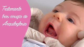 Tratamiento tras la cirugía de anquiloglosia o frenectomía lingual 👅👶🏼 [upl. by Aimit]