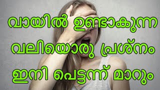 ഇനി വേദന സഹിക്കണ്ട വായിൽ ഉണ്ടാകുന്ന വായ്പുണ്ണ് മാറാൻ ഇനി ഇത് മതി Mouth ulcers remedies [upl. by Eerahc]