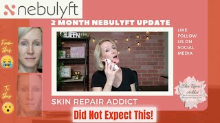 Nebulyft RF 2 Month Update  Before and After Photos [upl. by Marshall600]