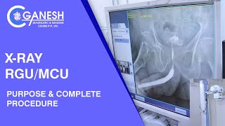 XRay RGUMCU Test Purpose amp Complete Procedure at Ganesh Diagnostic [upl. by Enasus]