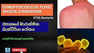 Streptococcus Toxic Shock Syndrome  STSS Bacteria  මාරාන්තික බැක්ටීරියා රෝගය stss streptococcus [upl. by Kovacev]