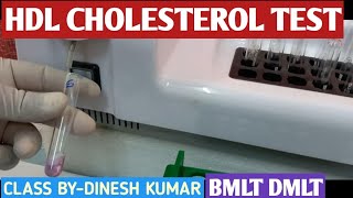 HDL Cholesterol Test Practical Video [upl. by Nuaj]