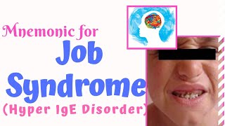 Job Syndrome Hyper IgE Syndrome Mnemonic [upl. by Opiak889]