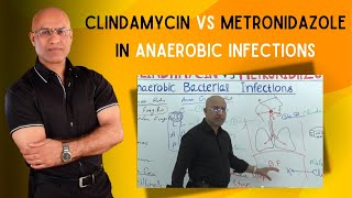 Clindamycin vs Metronidazole  Anaerobic Infections [upl. by Pennington]