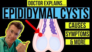 Doctor explains TESTICULAR LUMPS PART 1  EPIDIDYMAL CYSTS causes symptoms and treatments [upl. by Ahsiek]