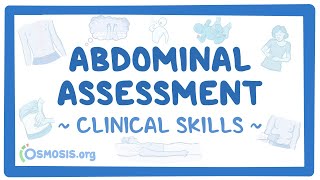 Abdominal Assessment Clinical Skills [upl. by Antoine]