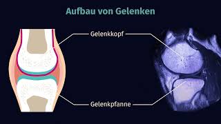 Gelenke – Bau und Typen einfach erklärt  sofatutor [upl. by Treblih]