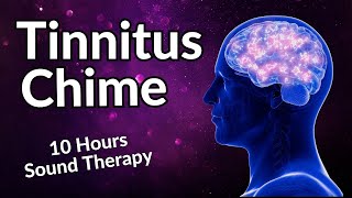 Tinnitus Chime  Sound Therapy For Relax amp Relief [upl. by Nnaik571]