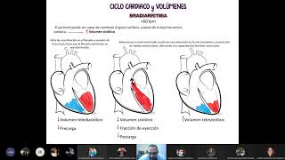 Clase bradiarritmias  Fisiopatología [upl. by Oaoj115]