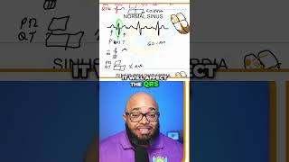 Understanding Hyperkalemia EKG Changes You Must Know [upl. by Loredo]