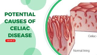 Potential Causes of Celiac Disease [upl. by Inglis]