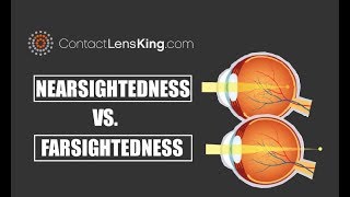 Nearsightedness Vs Farsightedness and the Difference Between the Two [upl. by Kciredes]