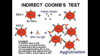 Indirect Coomb Test ICT [upl. by Ttej]