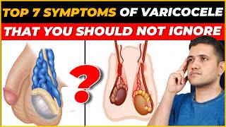 Top 7 Symptoms of Varicocele You Shouldn’t Ignore  Best Treatment Explained by Dr Gaurav Gangwani [upl. by Yltsew]