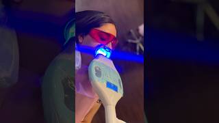 Cosmetic laser teeth whitening in the 559 fresno clovis teethwhitening fresnodeals [upl. by Noied]