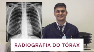 Radiografia do tórax anatomia e parâmetros de realização  Radiologia Prática [upl. by Tessa]