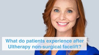 What do patients experience after Ultherapy nonsurgical facelift [upl. by Eitsrik]