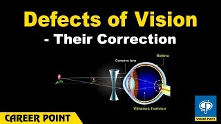 Defects of Vision and Their Correction Myopia And Hypermetropia [upl. by Denie]