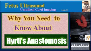 Fetus Ultrasound Why You Need to Know About Hyrtl’s Anastomosis [upl. by Harpp]