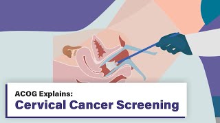 ACOG Explains Cervical Cancer Screening [upl. by Akirahc311]