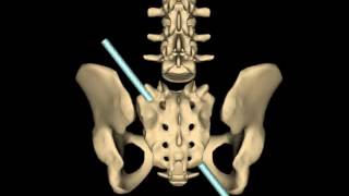 Forward Sacral Torsion Axis [upl. by Ecitnirp157]