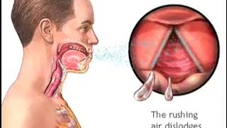 How Do We Cough  The Mechanism of Coughing  Cough Reflex Animation  Learn Human Body [upl. by Thorma628]