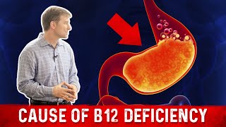 Vitamin B12 Deficiency The most common Cause – Dr Berg [upl. by Earlie]