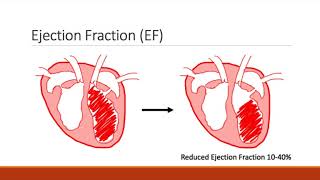 Entresto Patient Education Video [upl. by Nahgem738]