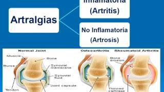 Semiologia Osteoarticular Dr Angel Granado [upl. by Packton]