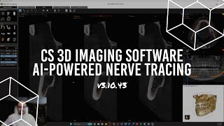 Carestream Dental CBCT  AIpowered Nerve Tracing in v31043 [upl. by Ahsemot]