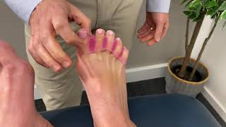 How to solve bunions in 3 steps [upl. by Alvin]