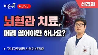 뇌혈관 치료 머리 열어야만 하나요  고대구로병원 신경과 한정훈 [upl. by Kerman]