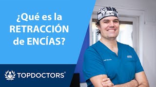 ¿Qué es la RETRACCIÓN de ENCÍAS  Dr Javier de la Cruz Conejo  Top Doctors 14 [upl. by Aseela]