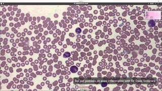 What blood looks like down the microscope [upl. by Congdon]