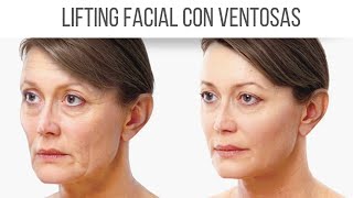 MASAJE FACIAL CON VENTOSAS PARA FLACIDEZ [upl. by Rebah574]