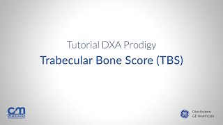 Tutorial DXA Prodigy  Trabecular Bone Score TBS [upl. by Cyrano35]