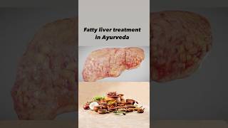 Heal Fatty Liver Naturally Ayurvedic Solutions Revealedfattyliver liverdetoxayurvedicherbs [upl. by Desmund]