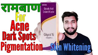 Acne Scars Pimple Marks Pigmentation Skin Whitening By Glyco 6 Cream Glycolic Acid Review [upl. by Tsai476]