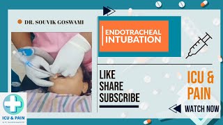 How to Perform Endotracheal Intubation A Clinical Demonstration [upl. by Neesay]