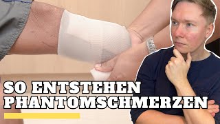 Phantomschmerzen und Schmerzwahrnehmung erklärt  Schmerzen nach Amputation  Mein Physio [upl. by Herates201]