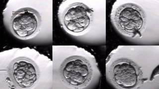 IVF PROCESS STEP BY STEP In Vitro Fertilisation Embryo cultivation [upl. by Calley241]