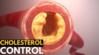 Cholesterol Control  Essential Strategies for Lowering It [upl. by Abernon]